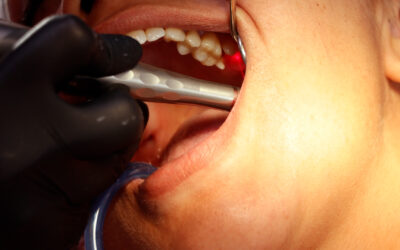 Eliminación de caries y preparación de cavidades.