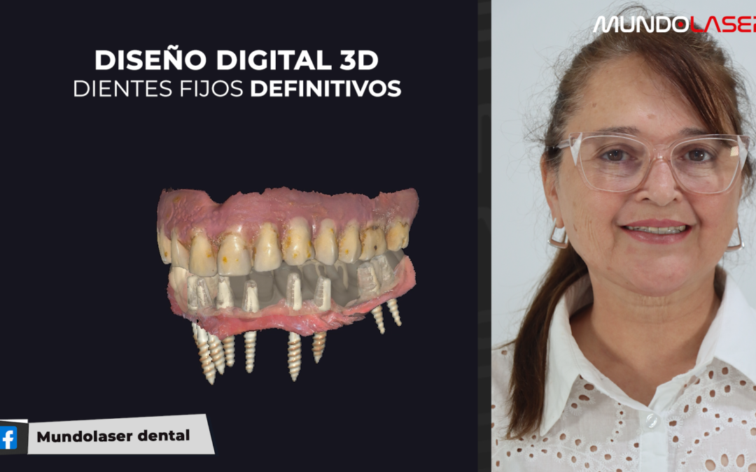 ¿IMPLANTES SIN HUESO? ¡MIRÁ CÓMO LO HICIMOS! | El Caso de Rosa