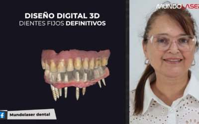 ¿IMPLANTES SIN HUESO? ¡MIRÁ CÓMO LO HICIMOS! | El Caso de Rosa